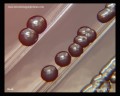 escherichia coli